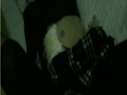 COLOSTOMIE DU PATIENT