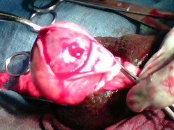 TESTICULE NECROSE ET PACHYVAGINALITE